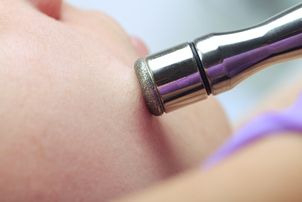 Mikrodermabrasion ist eine wirksame Methode zur Bekämpfung von Hautunreinheiten  und Akne