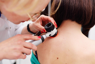 Erstuntersuchung beim Arzt, um den Hautauswuchs zu analysieren