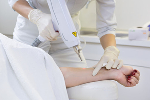 Komplikationen und Risiken der Tattooentfernung