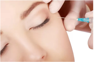 Dank Mesotherapie zu glatter und gesunder Haut