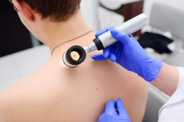 Suchen Sie einen Dermatologen auf, der ihr Lipom professionell untersuchen kann
