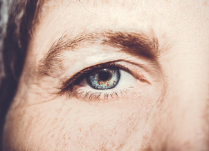 Die Augenlidstraffung gehört zu den häufigsten Schönheitsoperationen