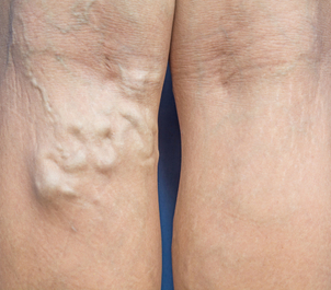 Was können Sie von Ihrem ersten Termin mit dem Chirurgen/Arzt erwarten