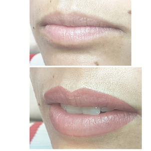 Die Lippen wirken voller und sind konturiert