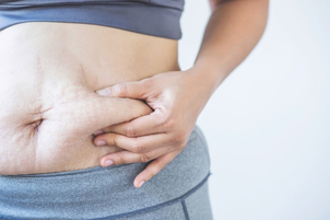 Ihr Spezialist wird die für Sie beste Methode zur Körpermodellierung bestimmen