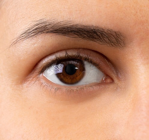 Wie kann ich Augenringe vorbeugen?