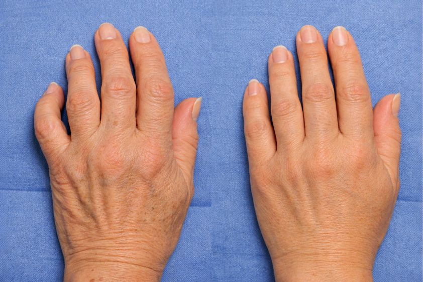 Handchirurgie