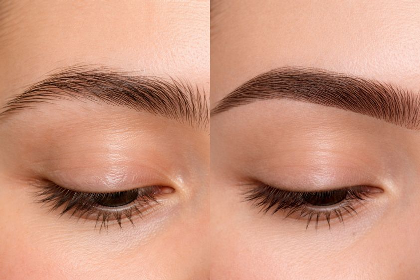Mikropigmentation