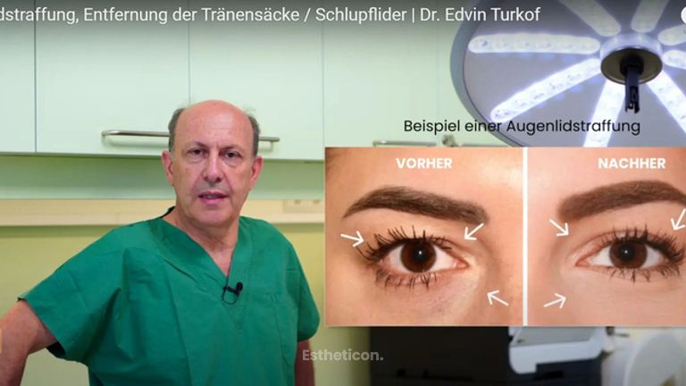 Video von Augenlidstraffung - Estheticon.de