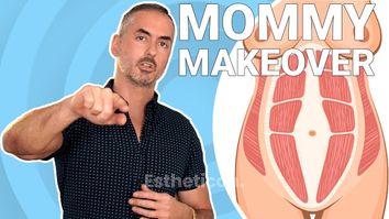 Dein Plastic Surgery Coach - Mommy Makeover