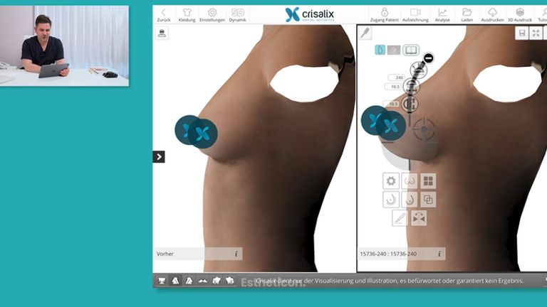 3D Darstellung - Dr. Med. Sebastian Dunda