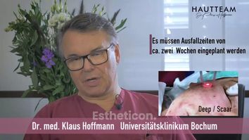 Narbenbehandlung und Faltenbehandlung mit CO2 Laser