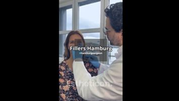 Fillers - Dr. med. Njde Hambarchian