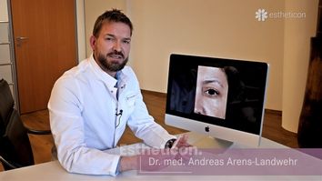 Behandlung von mimischen Falten durch Botox