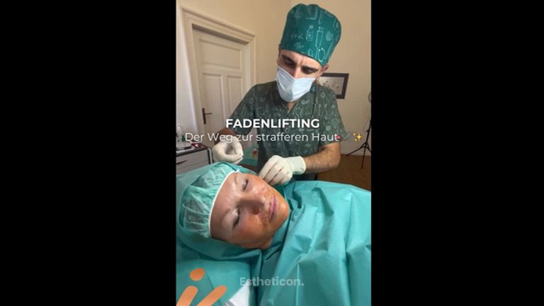 Fadenlifting - IKONA Aesthetics