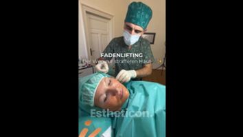 Fadenlifting - IKONA Aesthetics