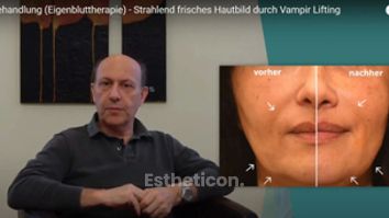 PRP Behandlung (Eigenbluttherapie) - Strahlend frisches Hautbild durch Vampir Lifting