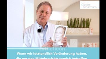 One Stich Facelift - Dr. med. Karl Schuhmann