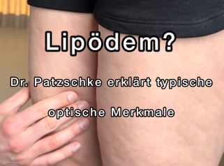 Lipödem Merkmale - THERESIUM │ DR. KLOEPPEL – Zentrum für Ästhetische Chirurgie & Medizin