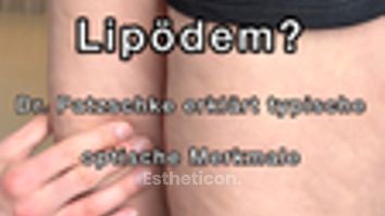 Lipödem Merkmale - THERESIUM │ DR. KLOEPPEL – Zentrum für Ästhetische Chirurgie & Medizin