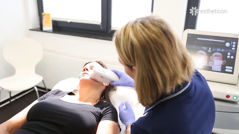 Ultherapy - die nicht-invasive Hautstraffung und Hautglättung mit fokussiertem Ultraschall