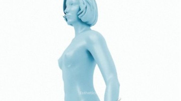 Bauchstraffung am Unterbauch