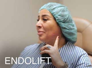 Endolift Behandlung von Dr. Pamirsad